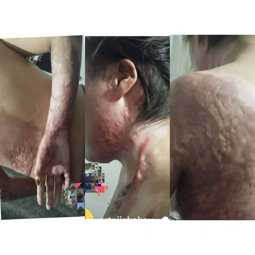 Сотрудник мэрии города Талас заживо поджег свою жену