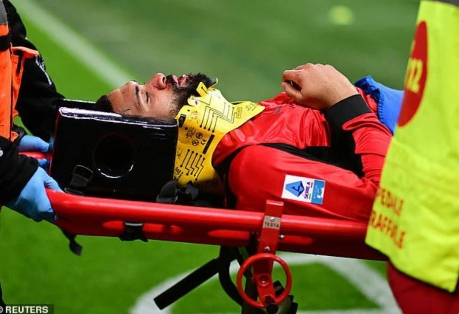 Лофтус-Чику прооперировали челюсть после тяжелой травмы в матче с "Пармой"