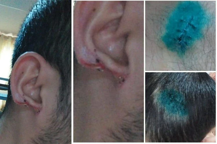 In Kochkor-Ata, a knife attack is being investigated against the backdrop of a family scandal and violence