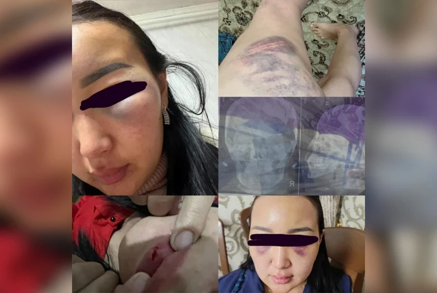 В Кызыл-Кие женщина обвинила экс-супруга — певца — в многолетнем насилии